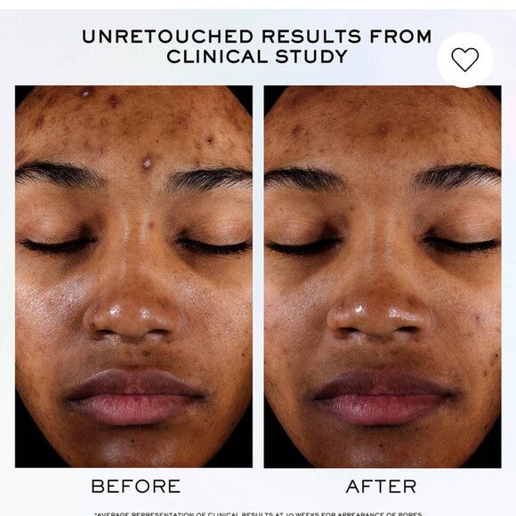 Lancome Clarifique Pro-Solution refining brightening serum 1.0 fl oz - Picture 5 of 13